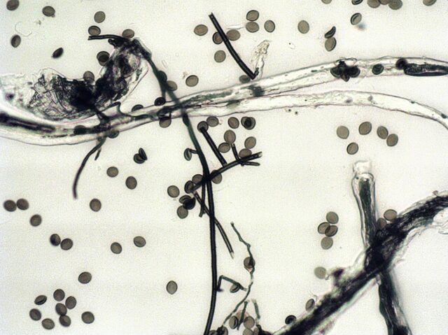 Chaetomium globosium Sporen und Papierfasern